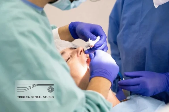 Dental Implants in New York