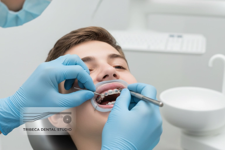 Do Braces Fix Overbite or Make It Worse