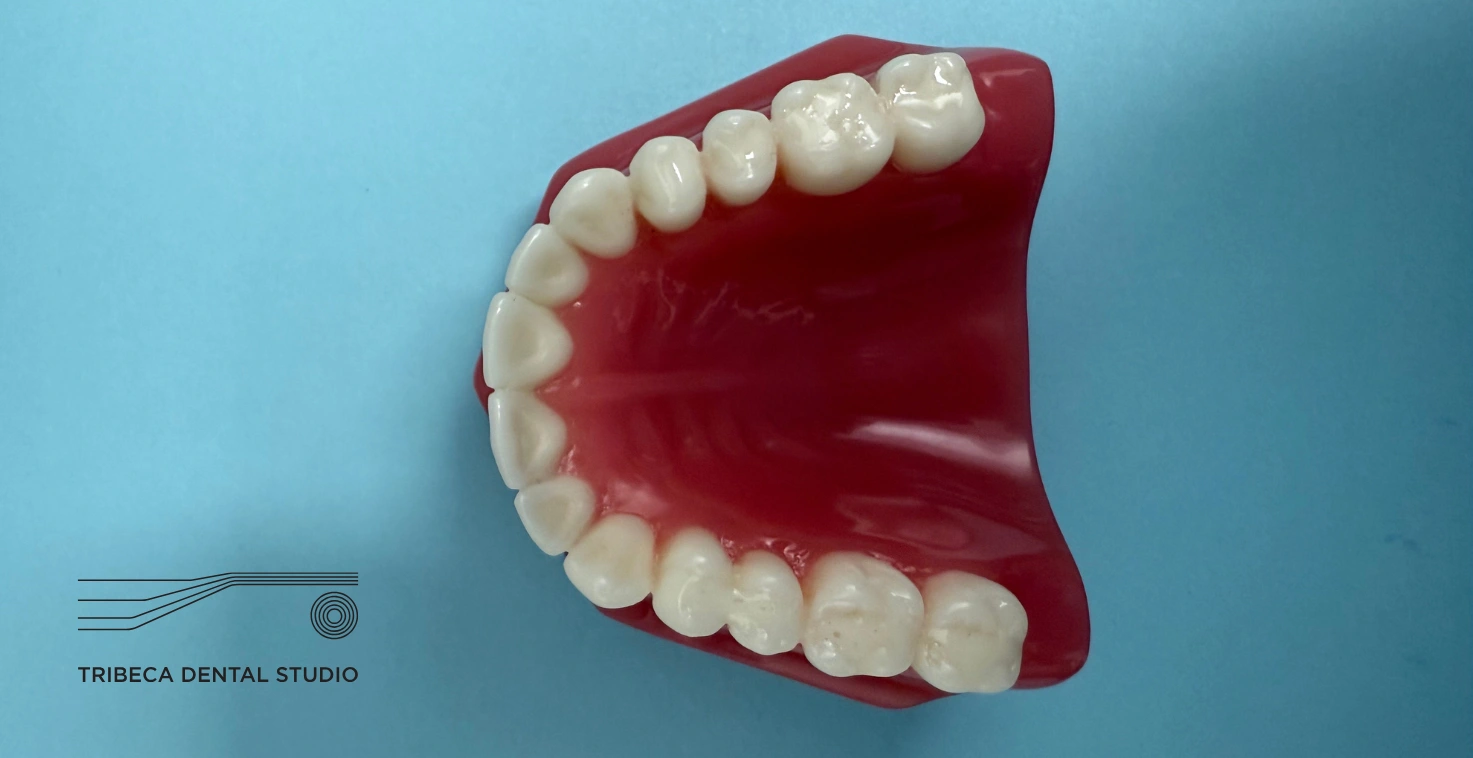 Dental Sealants In Tribeca, NYC
