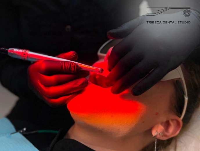 LANAP Laser Gum Surgery In NYC
