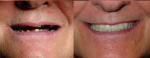 Before and After Cases