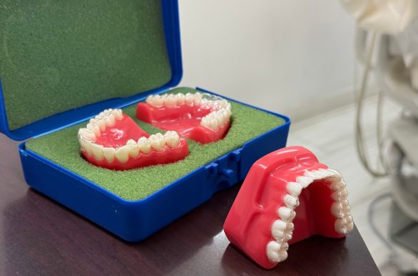 Invisalign Cost in NYC