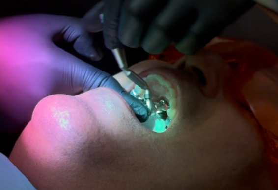 airway dentist for adults