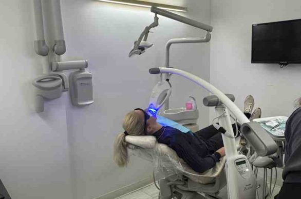 professional teeth whitening for sensitive teeth